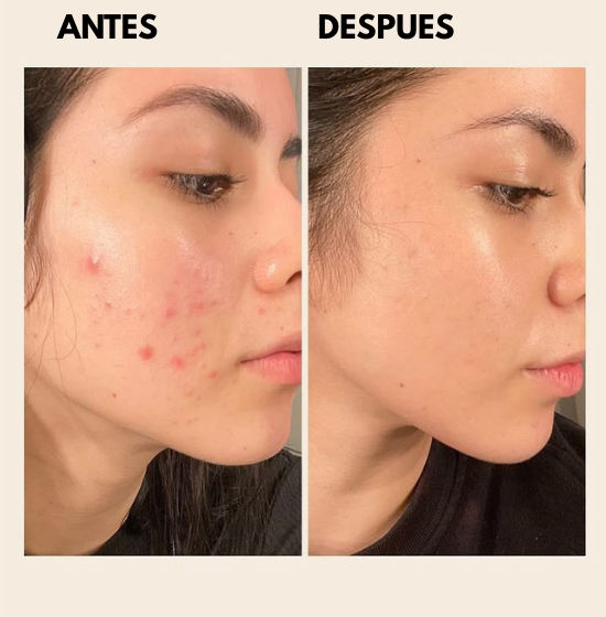 Dr. Althea Crema de Alivio 345 (50ml) - Piel Perfecta en 10 dias