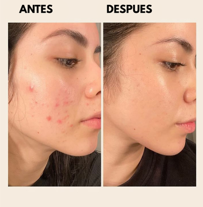 Dr. Althea Crema de Alivio 345 (50ml) - Piel Perfecta en 10 dias